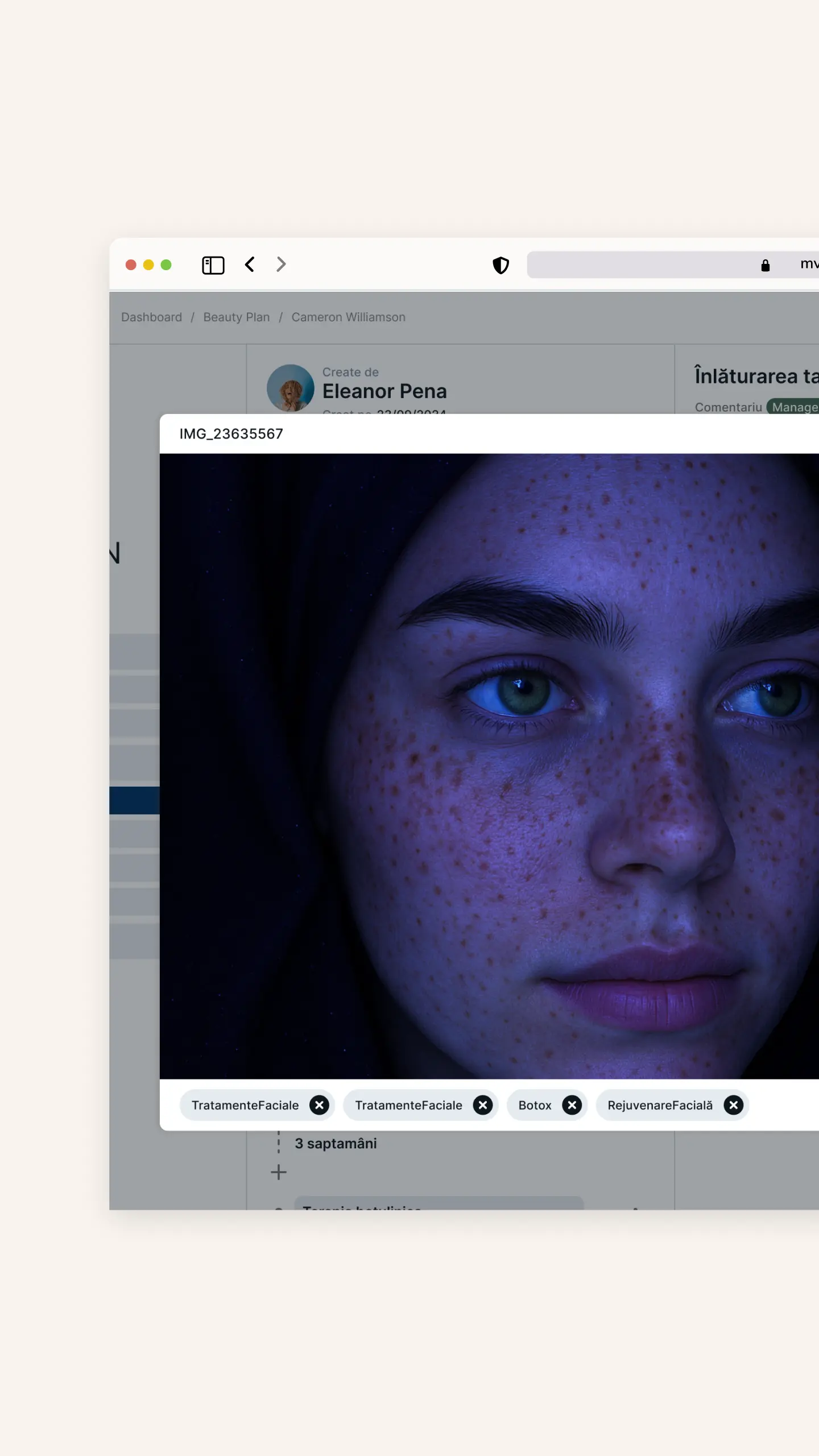 POSH Beauty CRM | Catalog inteligent de imagini medicale | Tag-uri automate pentru fotografii în funcție de tratament, zonă și categorie estetică – pentru arhivare și comparare vizuală ușoară